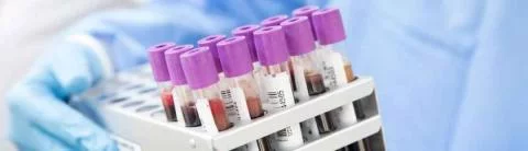 Chef / Cheffe de projet recherche clinique